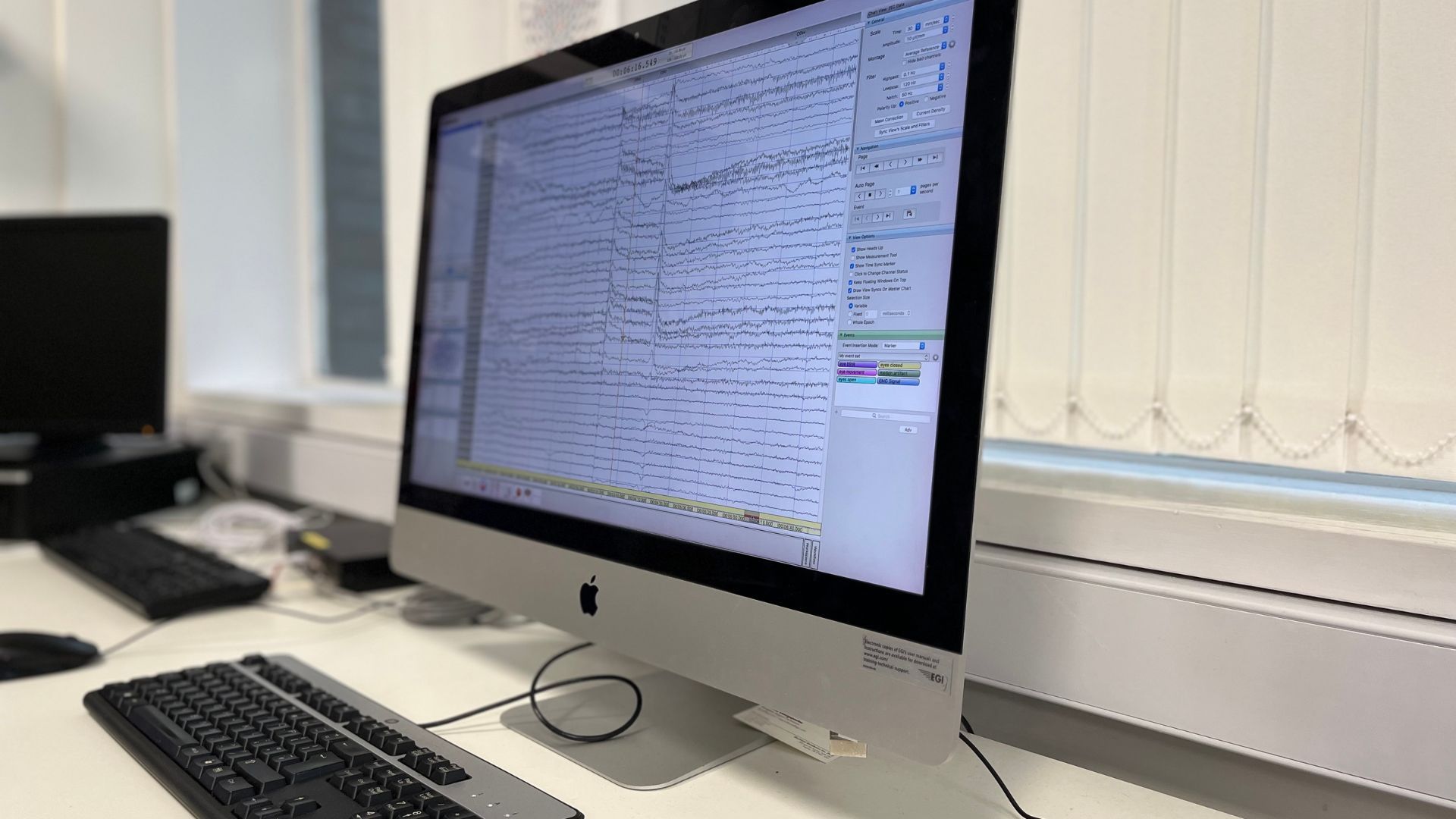 A computer shows data picked up by EEG technology.