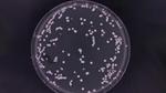 Feature image - Could this bacteria be the root cause of dandruff?